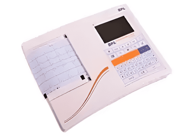 ontec ECG – channel 6
